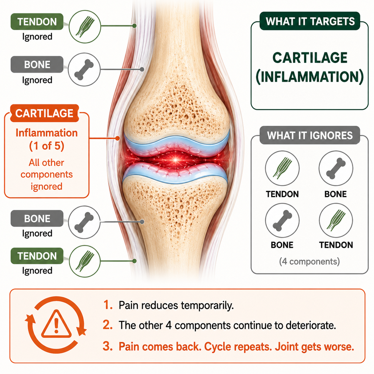 Joint diagram